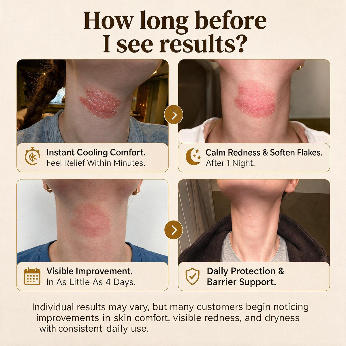 Advanced Psoriasis & Eczema Relief Cream - QZE